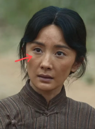 怀疑过杨幂年纪大，也怀疑过杨幂医美过度，万万没想到，杨幂眼袋大竟然是因为