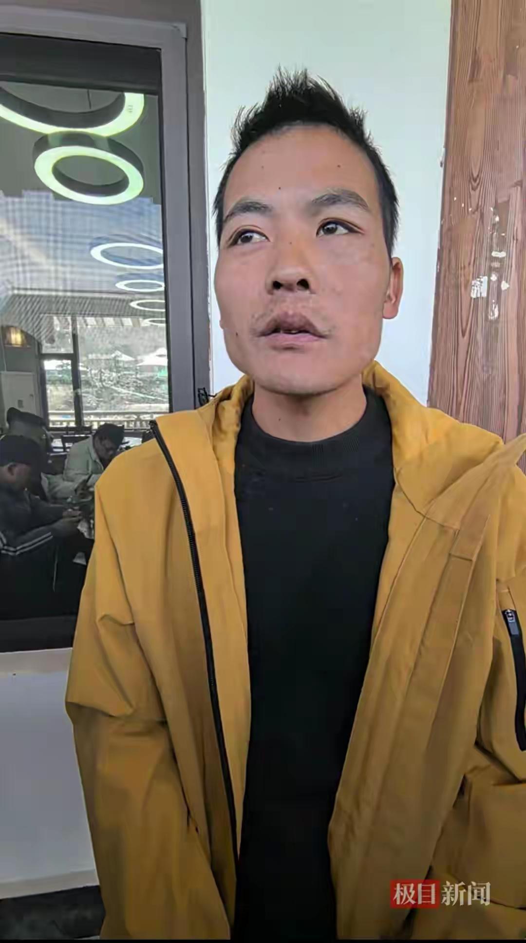 荒野求生选手“刀疤哥”回应网友：真相到底是什么？别被表象骗了！最近，热搜榜上