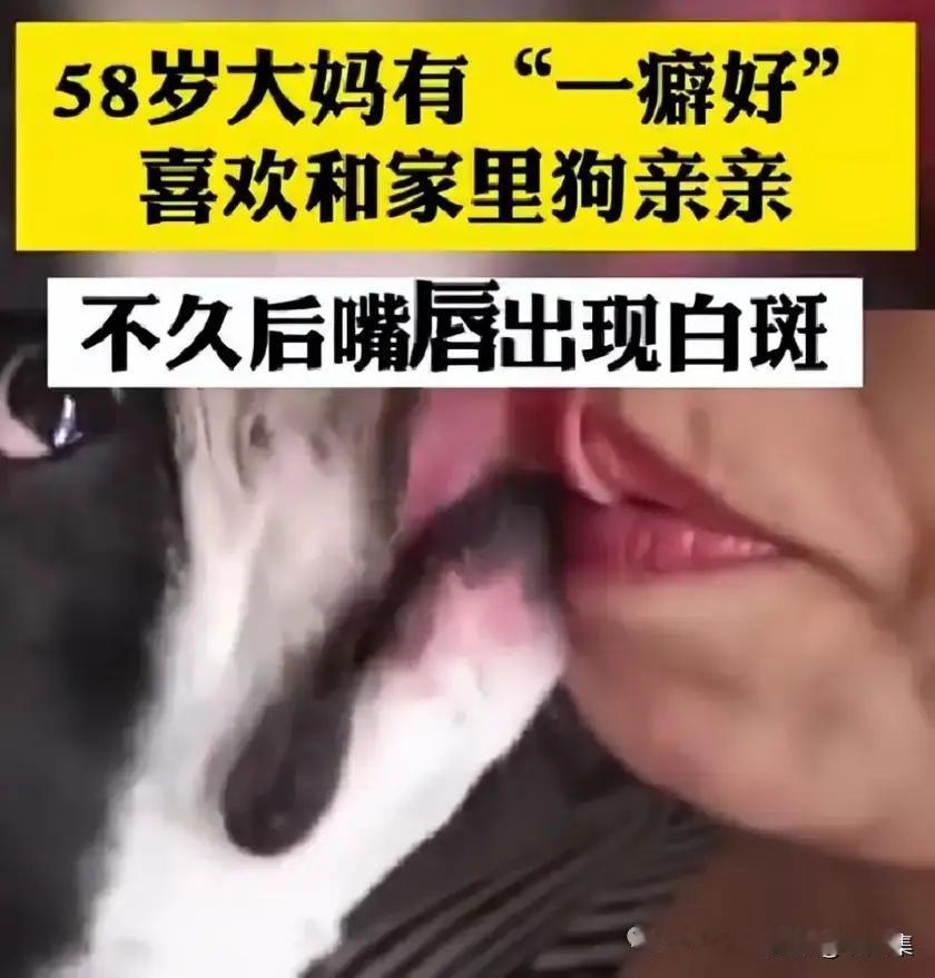 58岁大妈爱让宠物狗舔嘴，一有时间就亲昵一番，如今患病后悔莫及。当一只狗用湿润