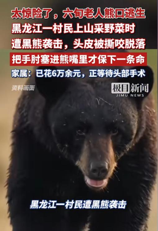 命不该绝！6月15日报道，黑龙江一位60多岁的大爷，上山采野菜时遭遇黑熊袭击，整