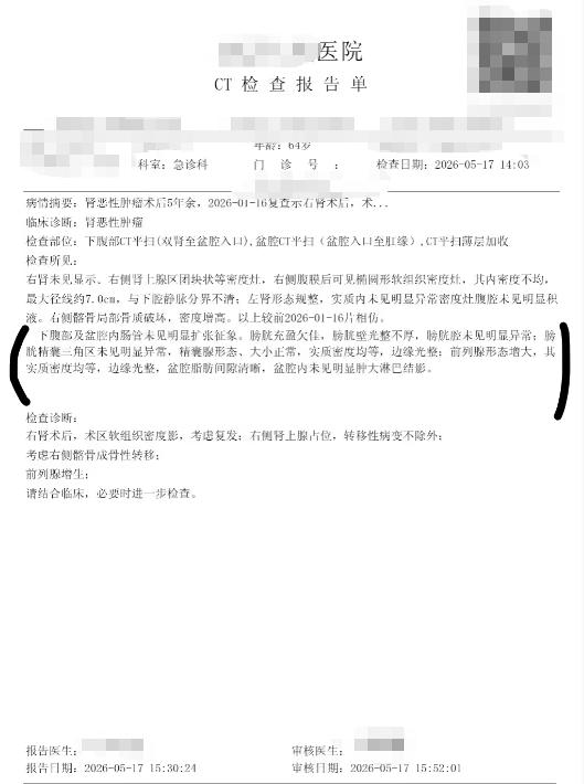 扶正消瘀法，中医调理肾脏肿物实用思路今年一月份的时候有个多年不见的