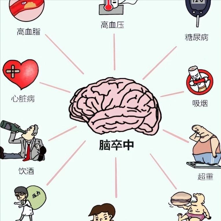 突发脑梗分三级：抢救时间决定后半生！第一级：轻微症状这时可能只是突然觉得一只