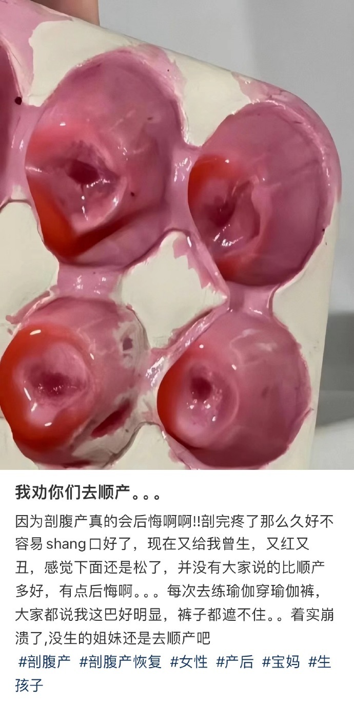 我劝你们去顺产。。。​​​