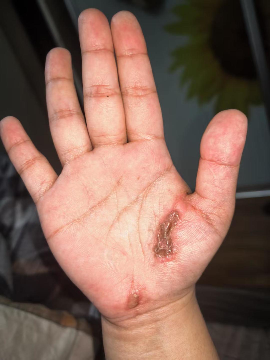 代价惨重，悔不当初！2026年3月5日，贵州遵义30岁孙女士在家沙发边充电边玩