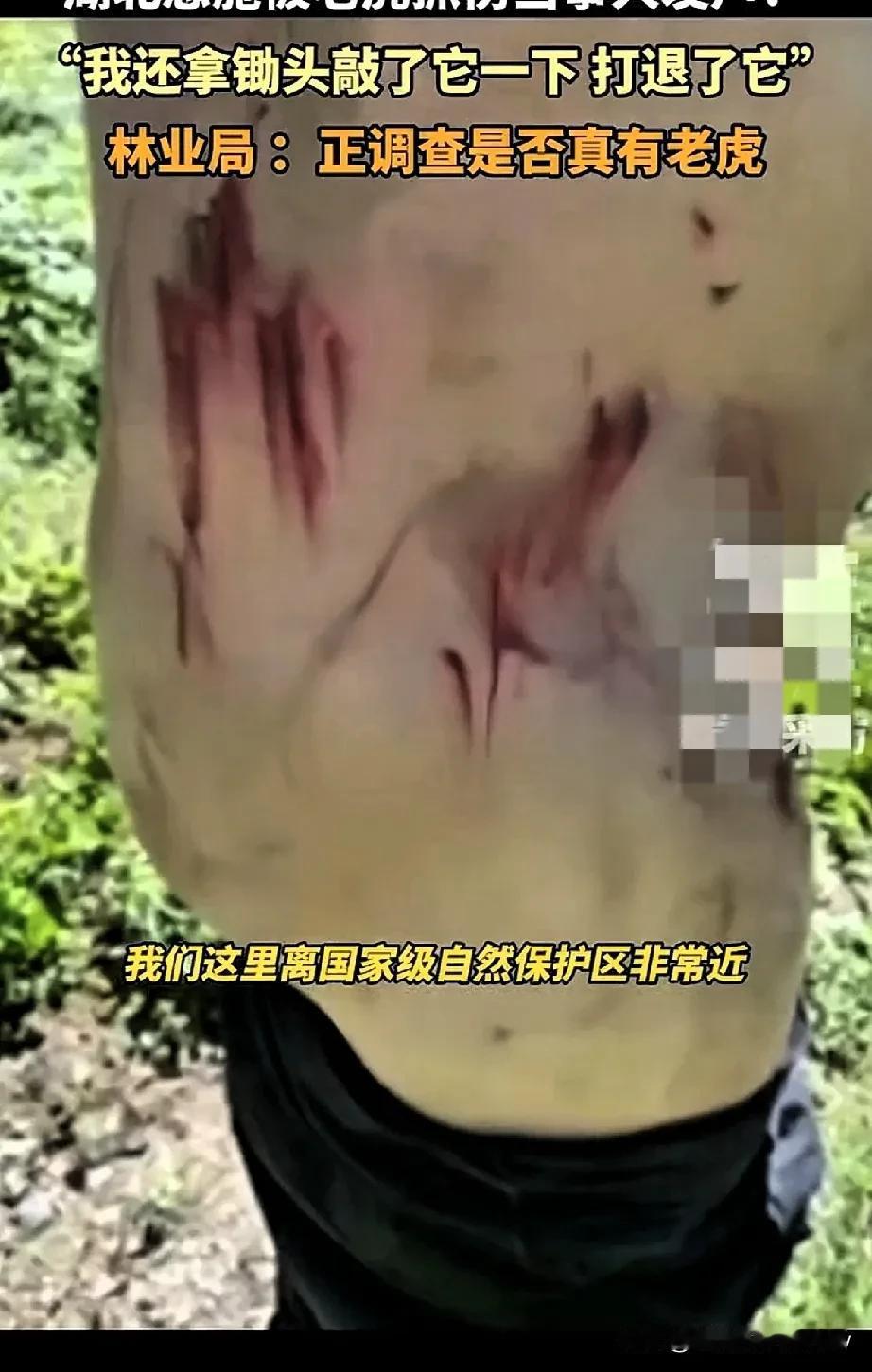 恩施村民遇老虎事件有疑点。疑点一，看伤痕，不像被猫科动物抓伤，抓痕明显不规则，