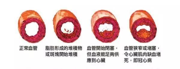 血管堵塞就吃它, 三高的“死对头”天然的血管清道夫