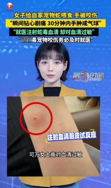 猪鼻蛇被说成最温顺，女子喂食被咬肿成气球，这到底算谁的错？最近江苏一个女生养