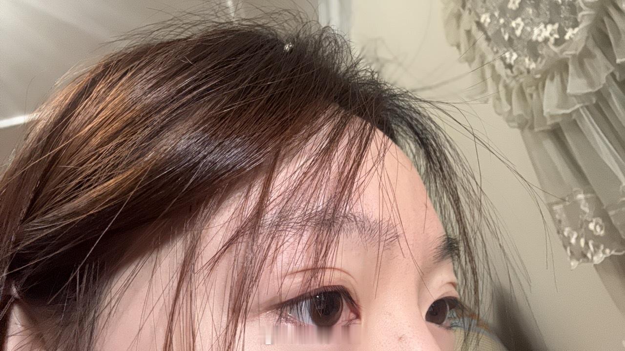 e好大的肿眼皮。。​​​