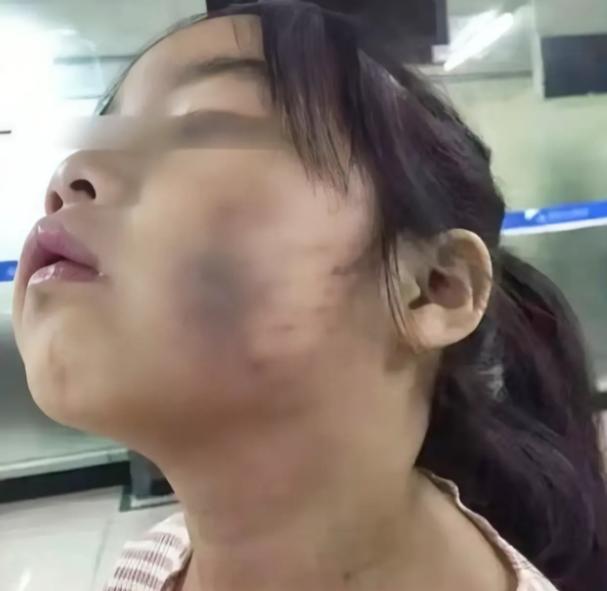 令人揪心！孩子被校园霸凌后该不该还手几个打人的说进去过很多次，美国多久