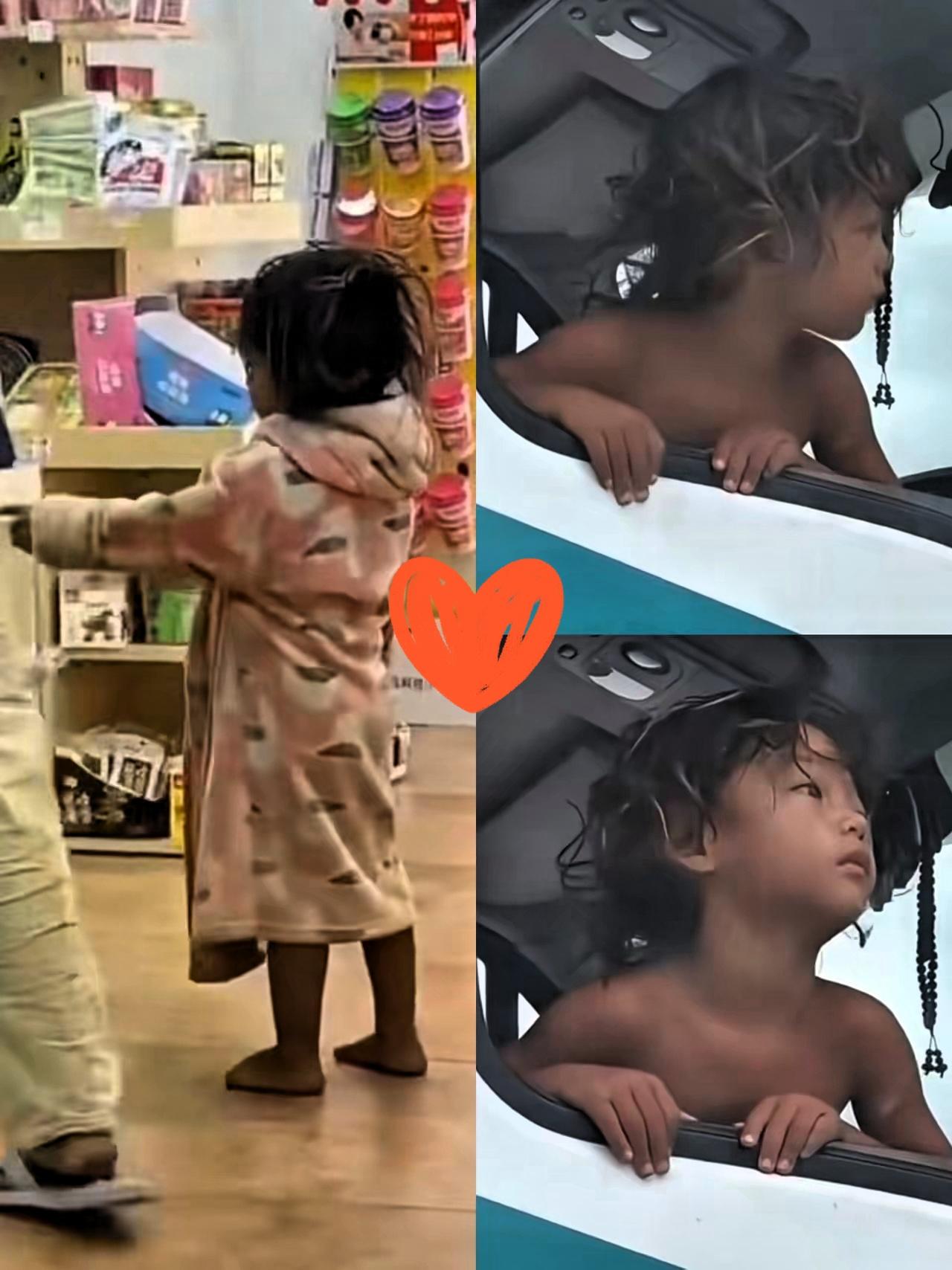 野人小孩父亲终于发声了！不是不给他穿衣服而是因为小孩穿了衣服湿疹更严重！