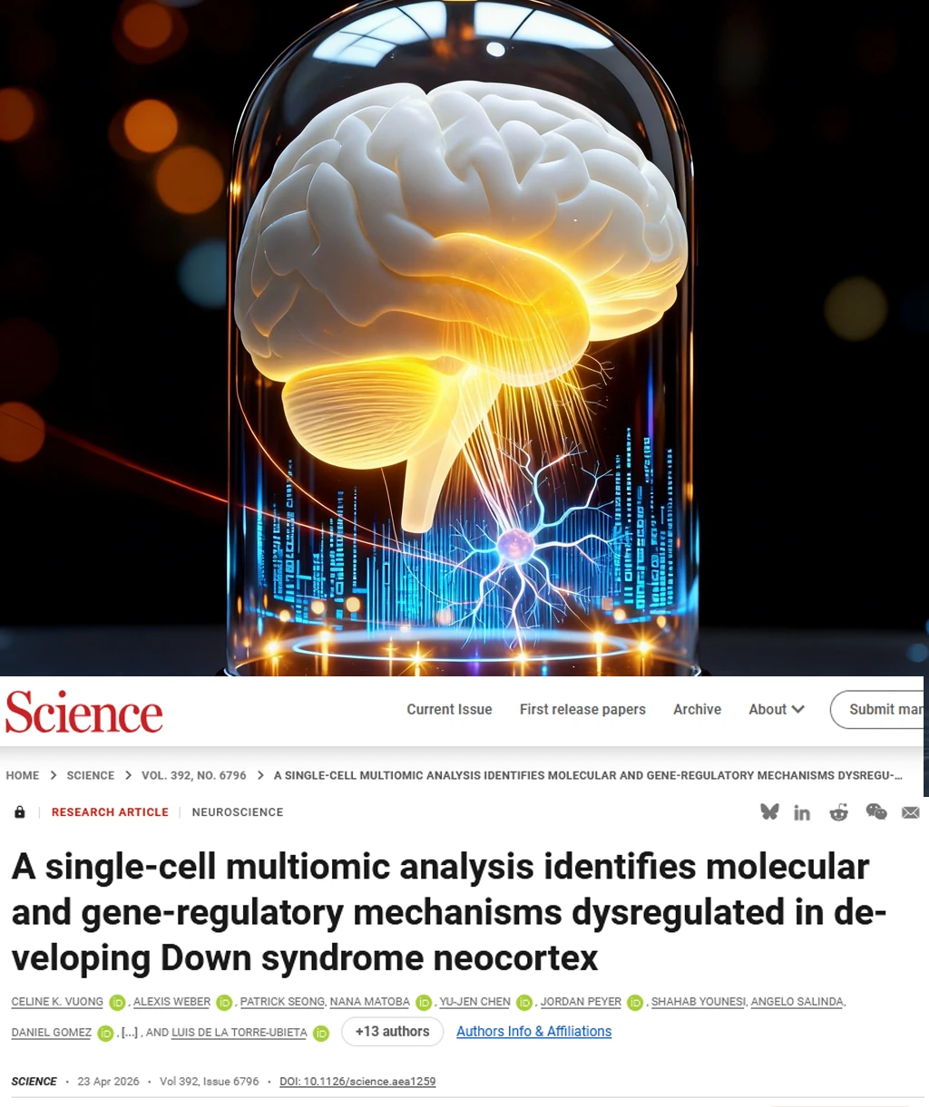 Science重磅-唐氏大脑是发育加速不是迟缓
