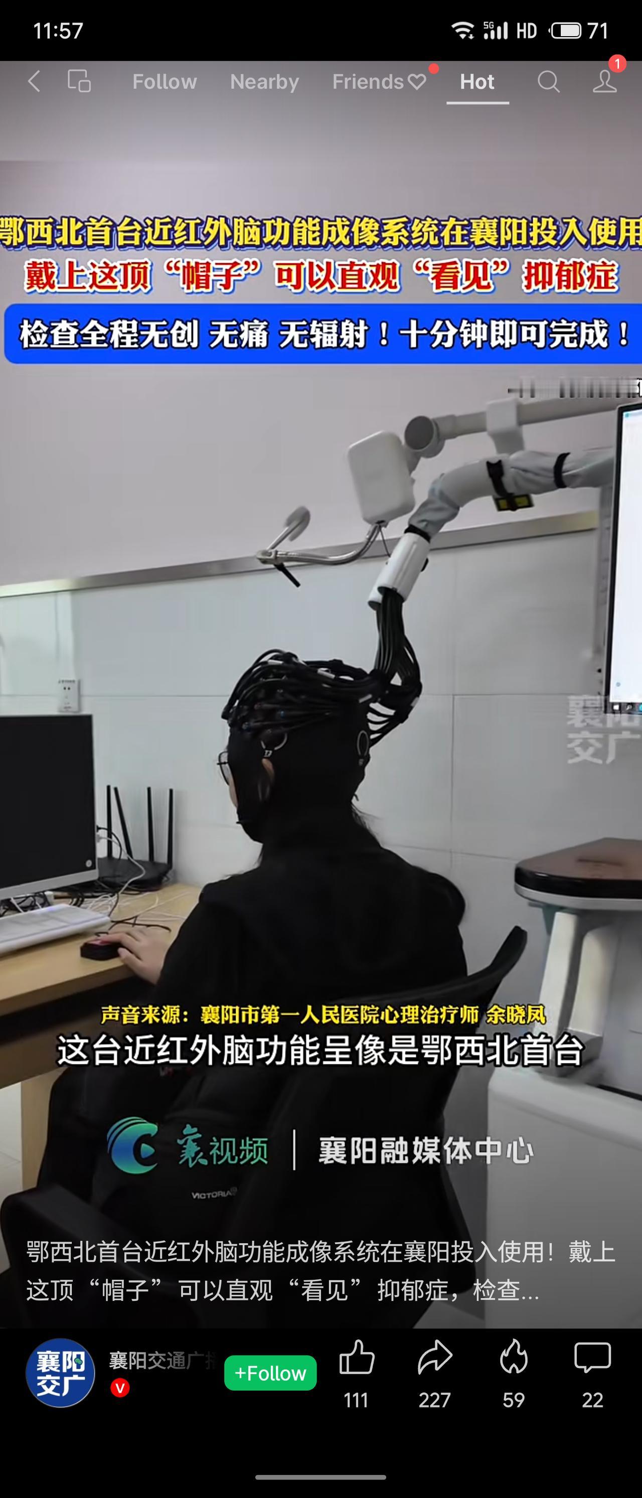 襄阳市第一人民医院引进鄂西北首台近红外脑功能成像系统，患者戴上特制“帽子”即可完