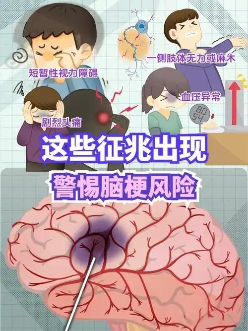 睡前这5个信号，可能是脑梗在“敲门”脑梗这事儿可不分白天黑夜，尤其到了睡觉