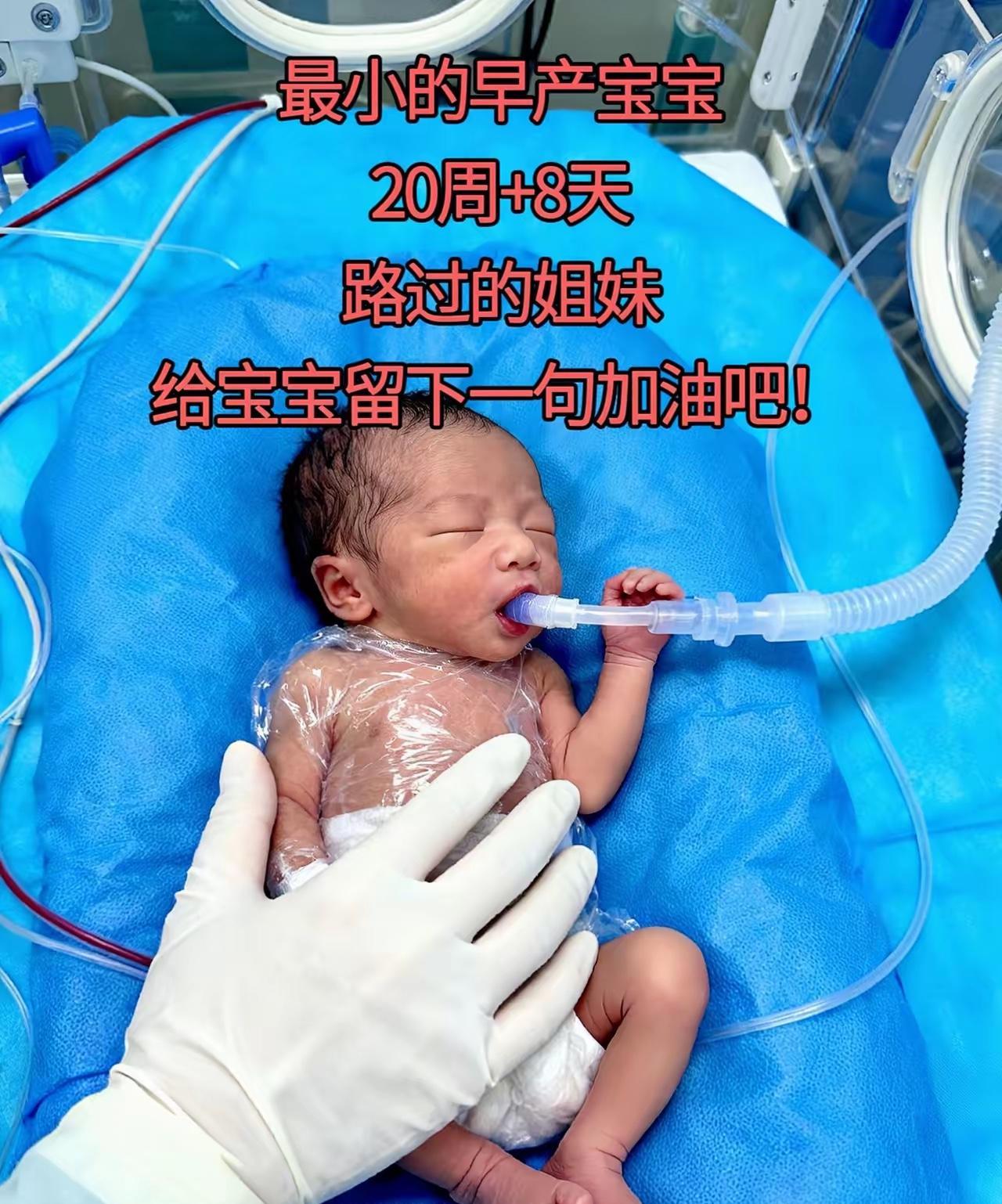 我的20+的早产宝宝，这是妈妈第一次看到你，不知道是不是有心灵感应，当妈妈靠近的