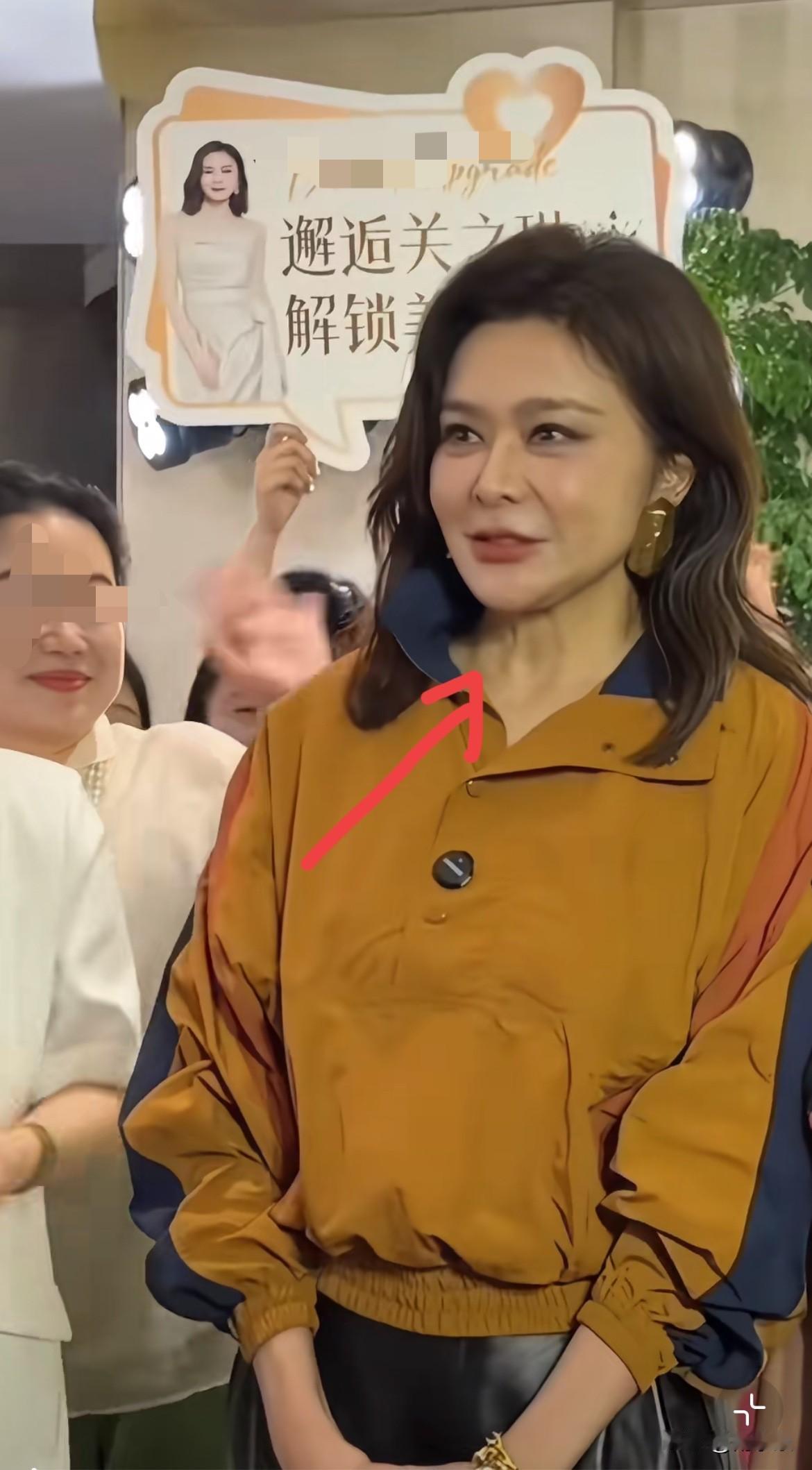 藏不住了！63岁关之琳因医美过度，面部僵硬得都不会笑了，使得颈纹尤其突出！瞧
