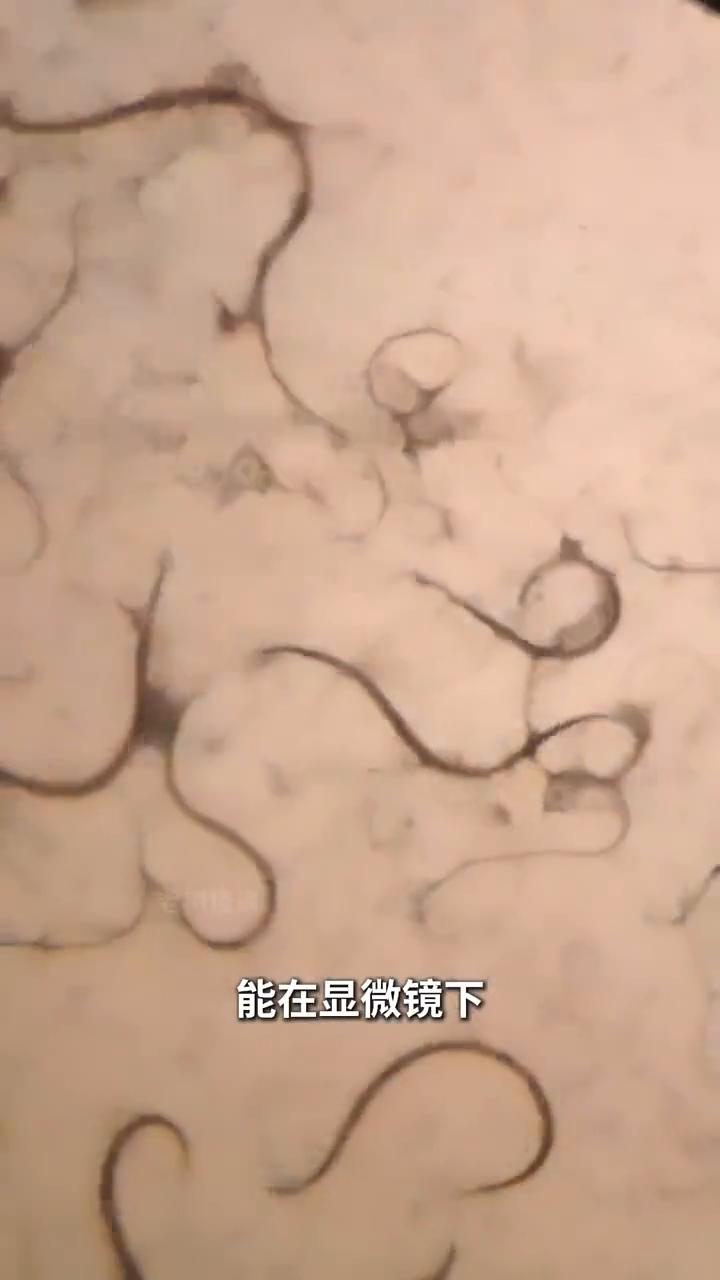 大蒜杀菌。这是一小块寄生虫，而这是生活中经常吃的大蒜。研究人员用捣蒜器榨取出新