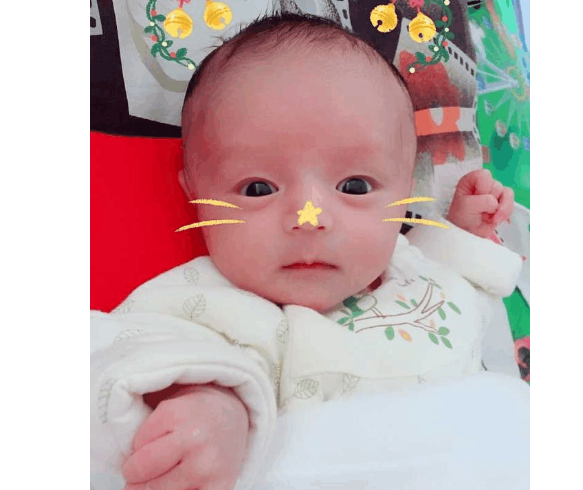 卸货啦, 剖腹产小王子一枚, 附症状给大家