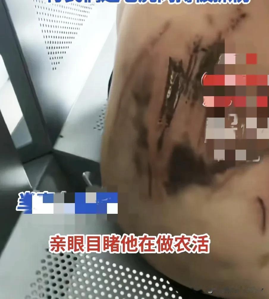 所谓遇见老虎被抓伤，有没有这种可能？该村民生性胆小，在山林中听到了一些风吹草动，