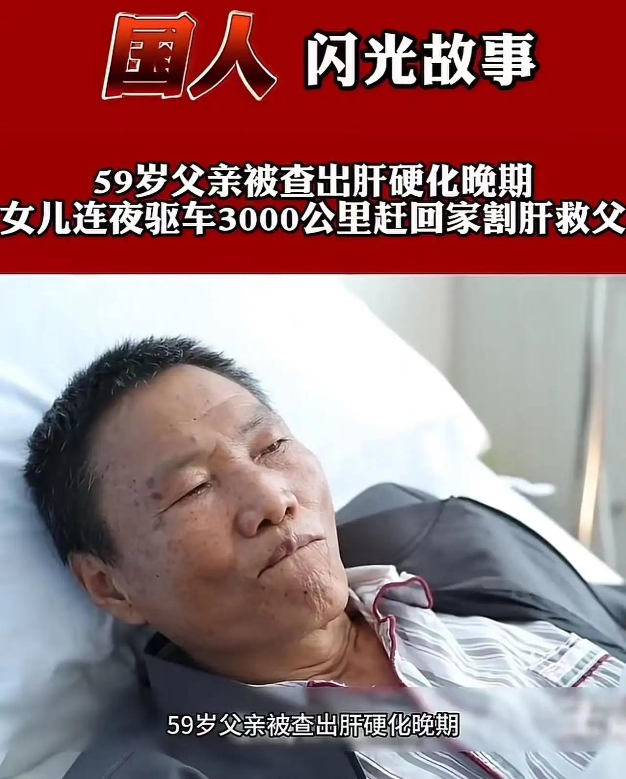 云南icon，59岁父亲患肝硬化晚期，医生下病危通知书，儿子决定放弃治疗，可女儿