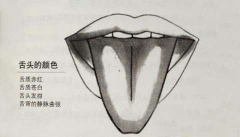 看舌苔颜色就能辨别癌症? 那还去医院检查做什么?