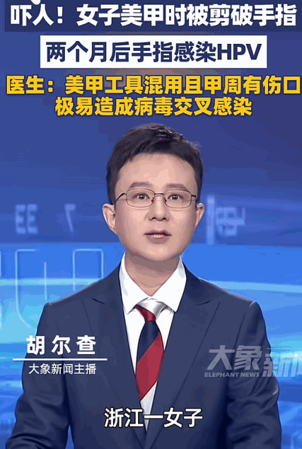 太吓人了。5月19日报道，浙江一位女士，美滋滋去做美甲，只是被剪破个小小的伤口，