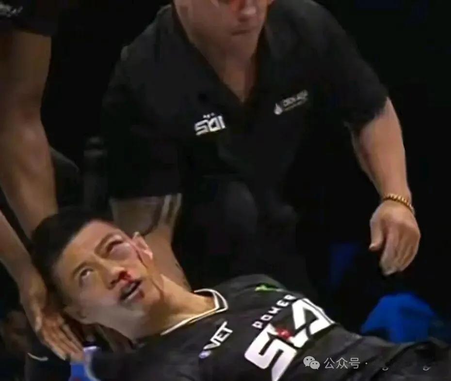 10月31日，通背拳传人赵鸿刚在UFC旗下的PowerSlap赛场遭遇惨败。他