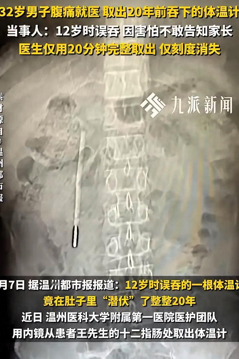 32岁的王先生最近肚子总不舒服，去温医大附一院龙港院区做了个腹部CT。结果显示