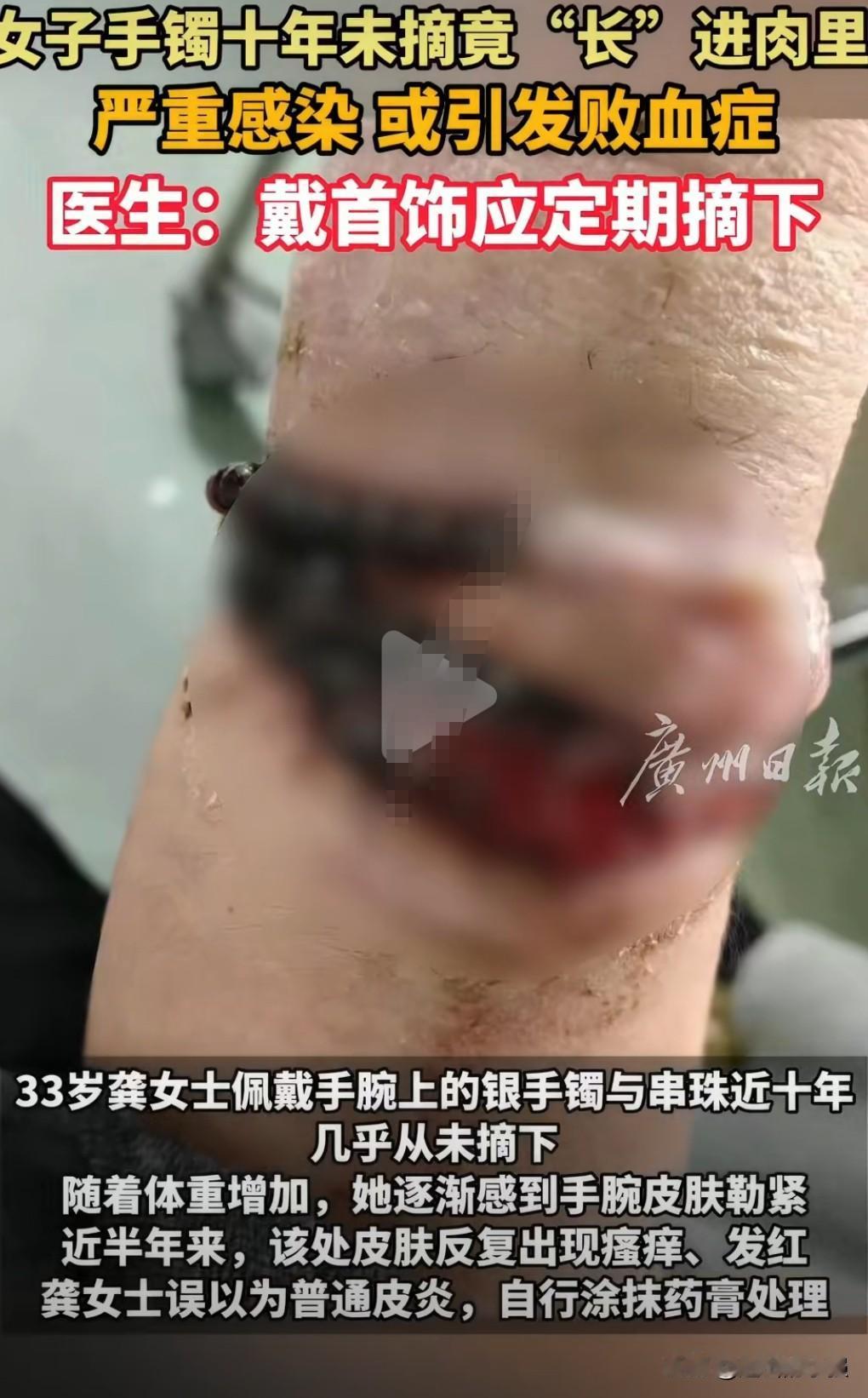 这也太离谱了吧，反应这么迟钝的吗？如果不是在网上亲眼所见，我是万万不敢相信竟然