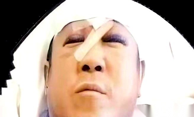 回看2001年曾志伟那桩轰动全港的会所遇袭案，最扎眼的从来不是那带血的烟灰缸，而是摆在台面上那650