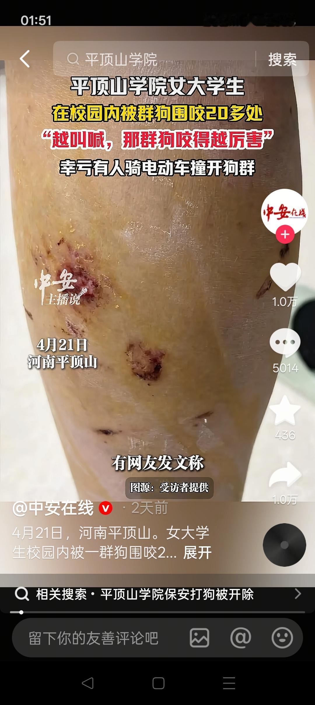 平顶山学院女生被狗群围咬，这只是被迫吞下当年“愚善”种下的恶果而已！202