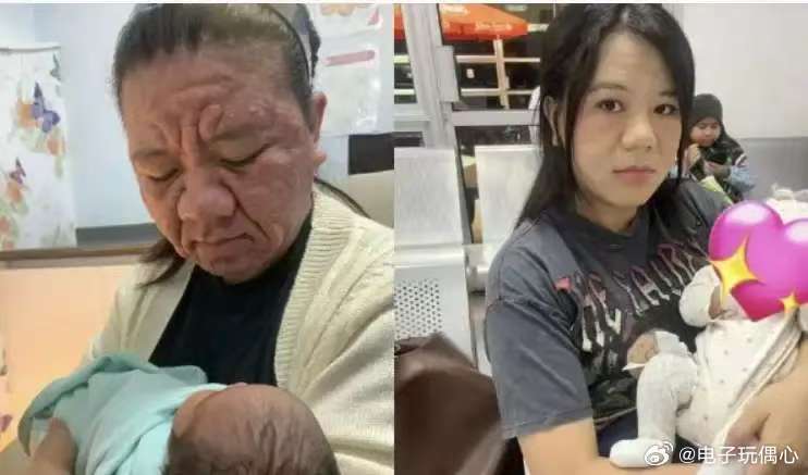 32孕妇生孩子前后容貌大变样。