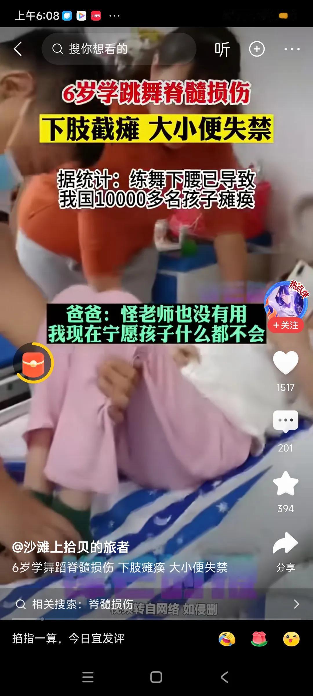 转发网友的，说是小女孩学跳舞，也有风险存在，搞不好，身体受损害，造成瘫痪，太吓人