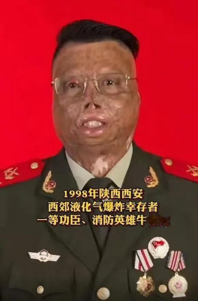 致敬消防英雄牛相成!舍身救人烧伤面积达97%，立一等功！