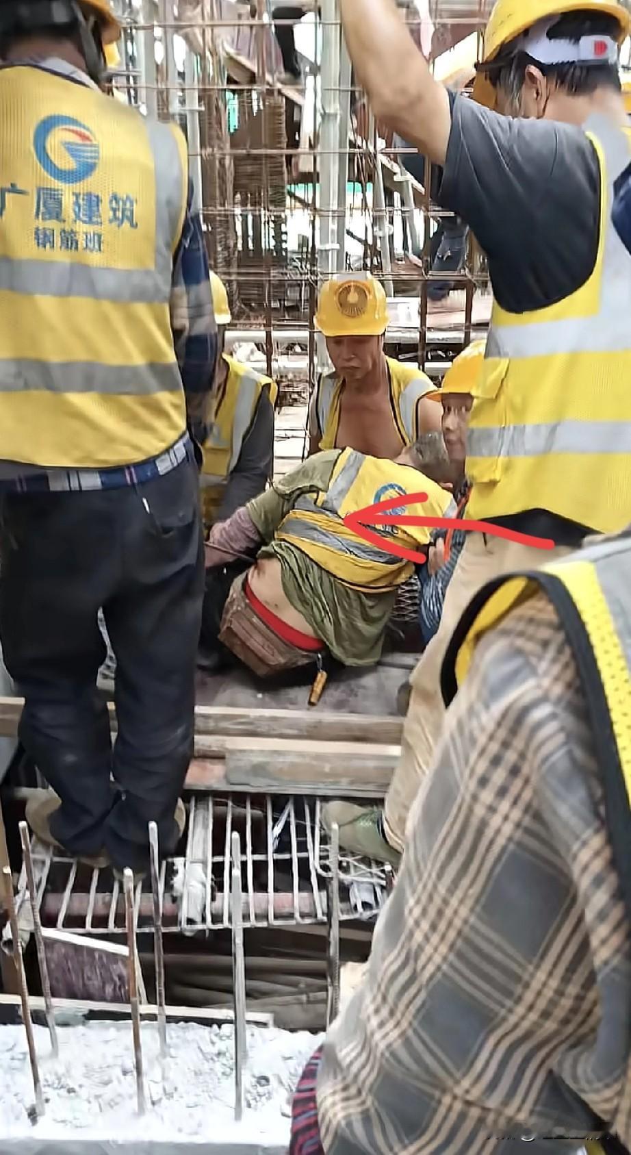 这位农民工太不幸了，在工地被钢筋刺穿腹部，看着有点严重啊。欣慰的是，他的工友们