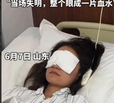 女子被射瞎最新进展！肇事男30万私了，景区内幕曝光，官方出手了最近，山东潍坊