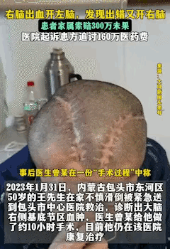 包头市中心医院这事儿，说出来比相声段子还魔幻！53岁的货车司机老王，三年前在家滑