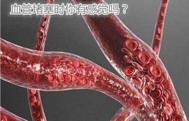 这个小动作每天做15分钟, 血栓没了, 血压血脂降了, 血管也不堵了