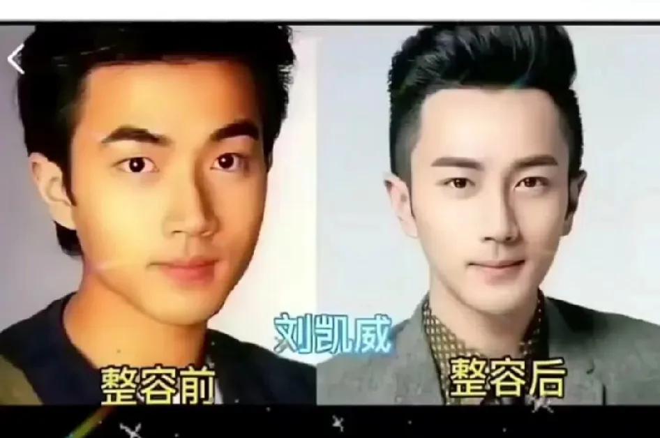整容前后变化很大的俞灏明。整容前后变化很大的胡歌。整容前后变化很大的陈浩民。