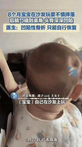 “世上没有后悔药！”广东珠海，一名8个月大的婴儿从沙发上摔下来，头磕在了茶几上，