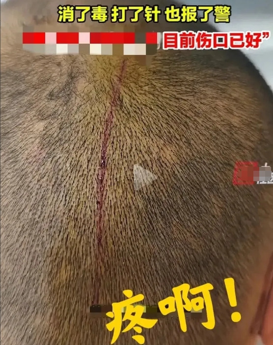 报警有用吗？报警抓谁？5月6号，江苏苏州，一光头男子正在大街上准备吸烟，烟还没