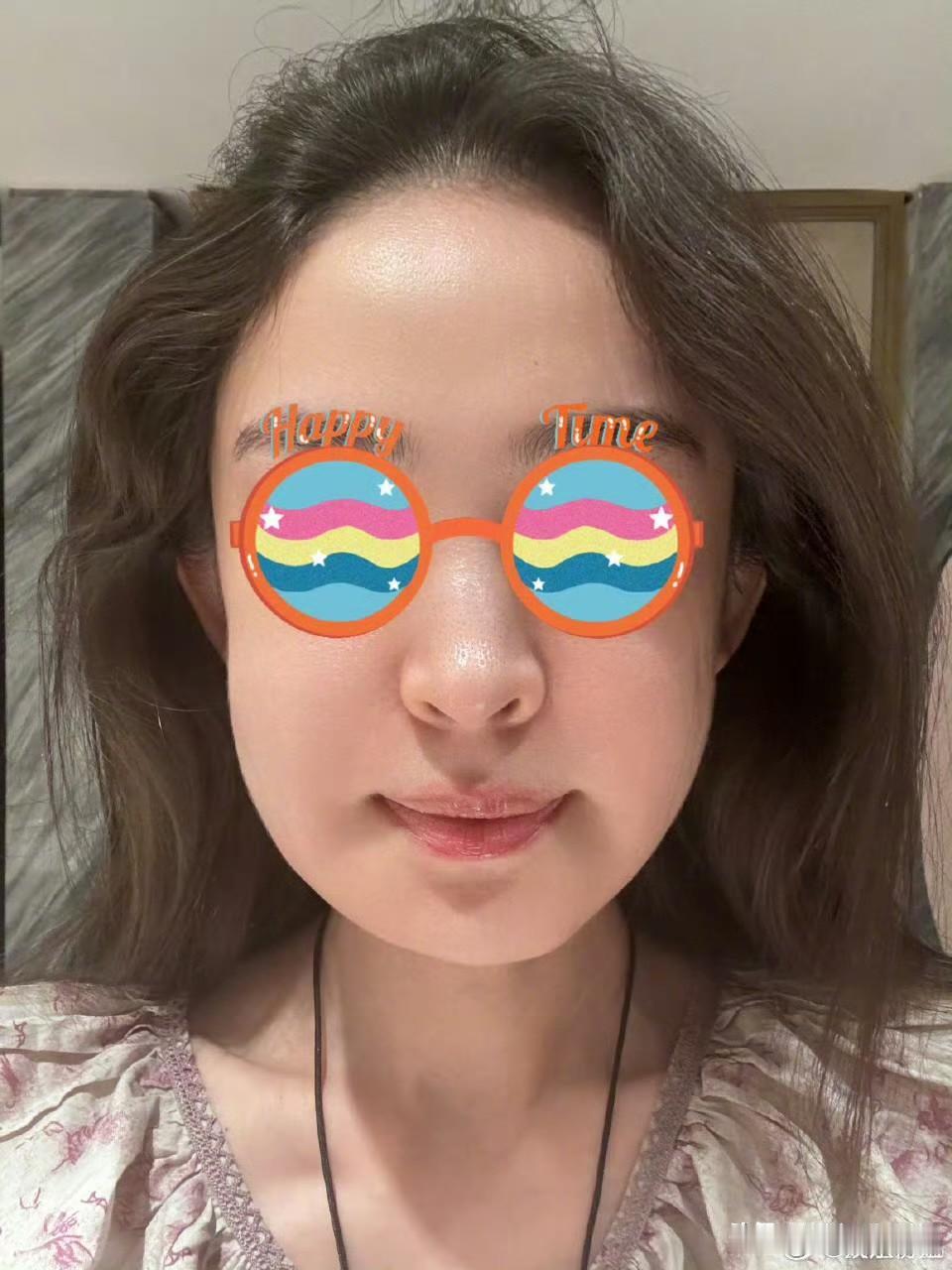 嫉妒让人失去理智娜扎说她因为牙龈肿了，连带着脸也肿了！还发了图片，可是这不就