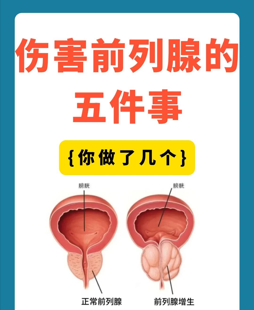 伤害前列腺的5件事，男性尽量少做