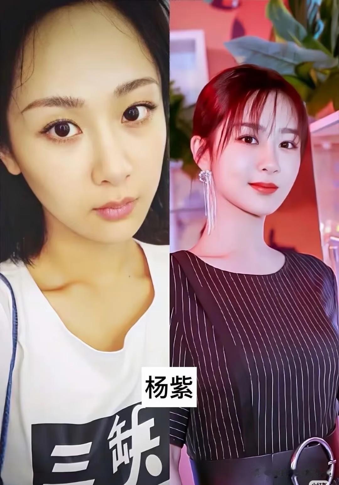女明星素颜出镜，谁才是天生好颜值一起来看女明星妆前妆后对比，素颜是本真模样，上