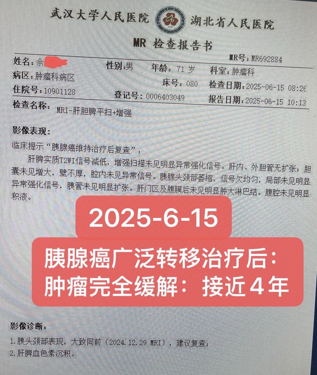 胰腺癌广泛转移：目前无肿瘤近4年。患者男，67岁，时间顺序：1. 临床...