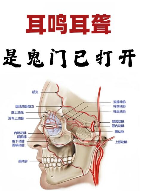治疗耳鸣的关键就在身体内