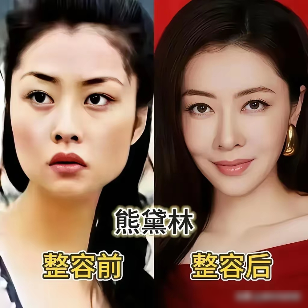 沈梦辰承认整容，评论区居然全在夸她。出道这些年，沈梦辰从轮廓到五官，从肤色到体态，一步步变美。早年因