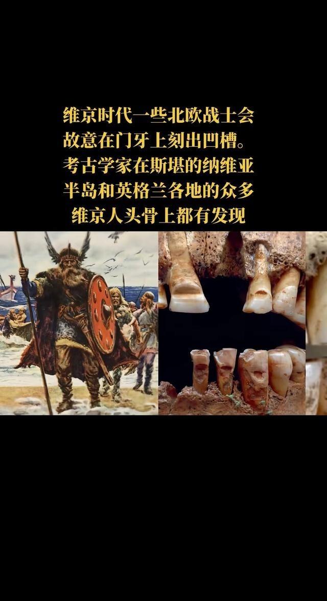 在维京时代，一些北欧战士会故意在门牙上刻出凹槽。考古学家在斯堪的纳维亚半岛和英格