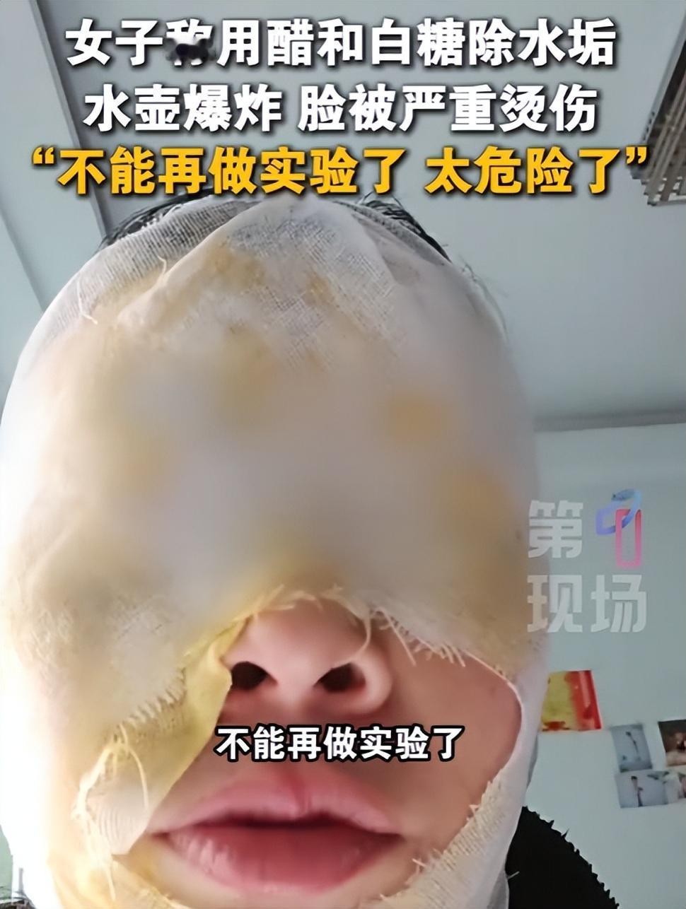 脸离保温壶口还没十厘米，滚烫的液体“噗”地喷出来——邯郸女子这一凑，直接