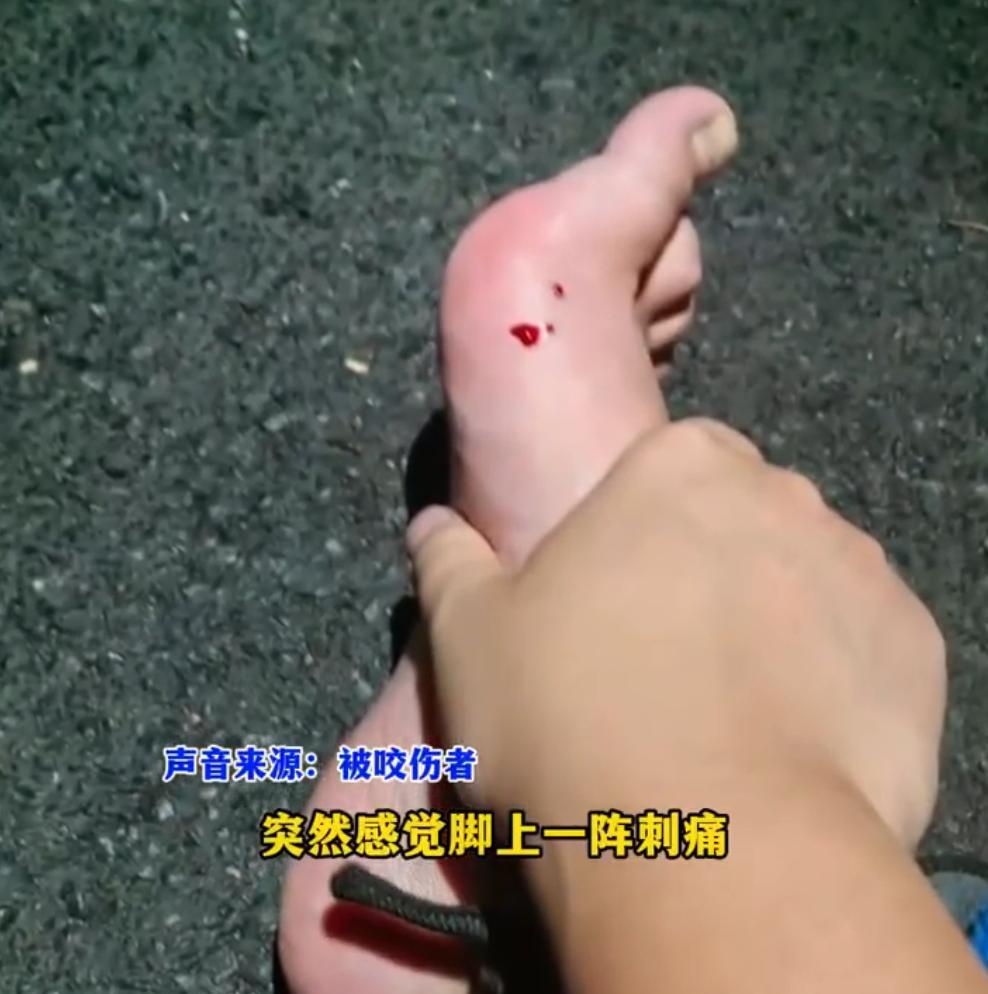最近，安徽省合肥市的李女士晚饭后，穿着一双人字拖去大蜀山爬山遛弯儿。当时和一大波