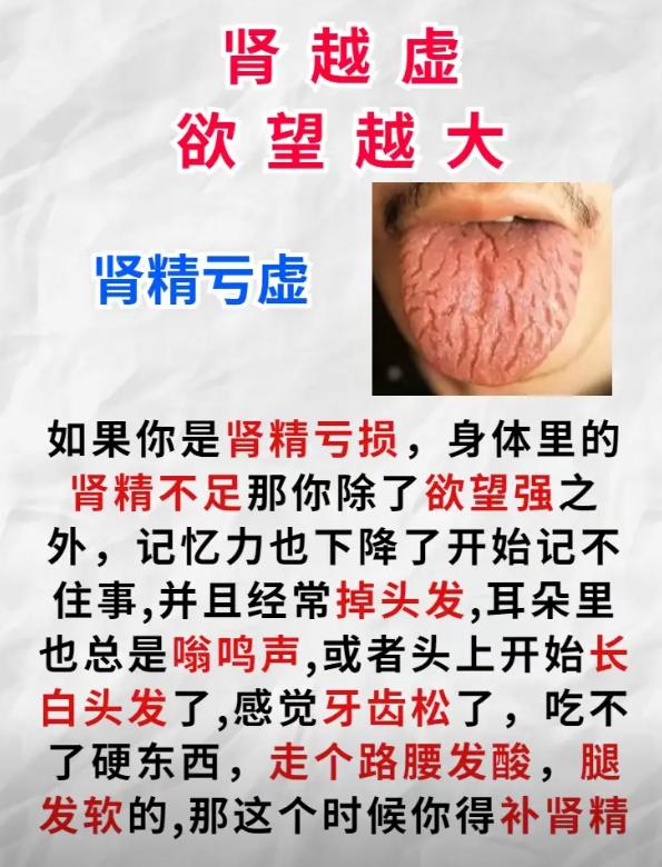 越虚越想？这两种肾虚，都可能让你控制不住